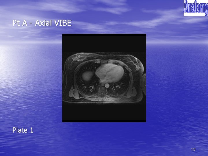 Pt A - Axial VIBE Plate 1 15 