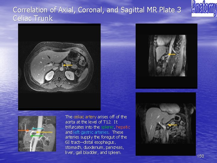 Correlation of Axial, Coronal, and Sagittal MR Plate 3 Celiac Trunk The celiac artery