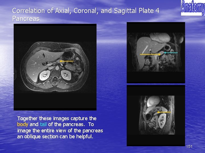 Correlation of Axial, Coronal, and Sagittal Plate 4 Pancreas Together these images capture the