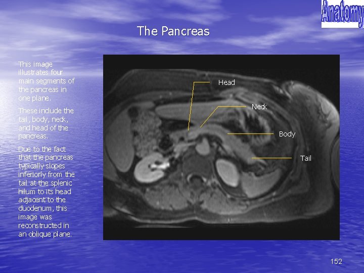 The Pancreas This image illustrates four main segments of the pancreas in one plane.