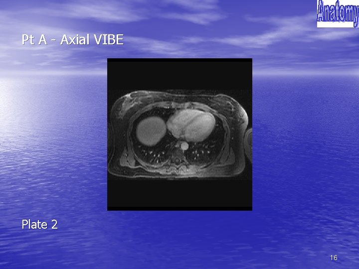 Pt A - Axial VIBE Plate 2 16 