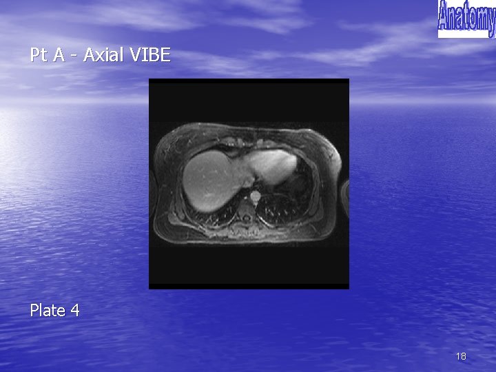 Pt A - Axial VIBE Plate 4 18 