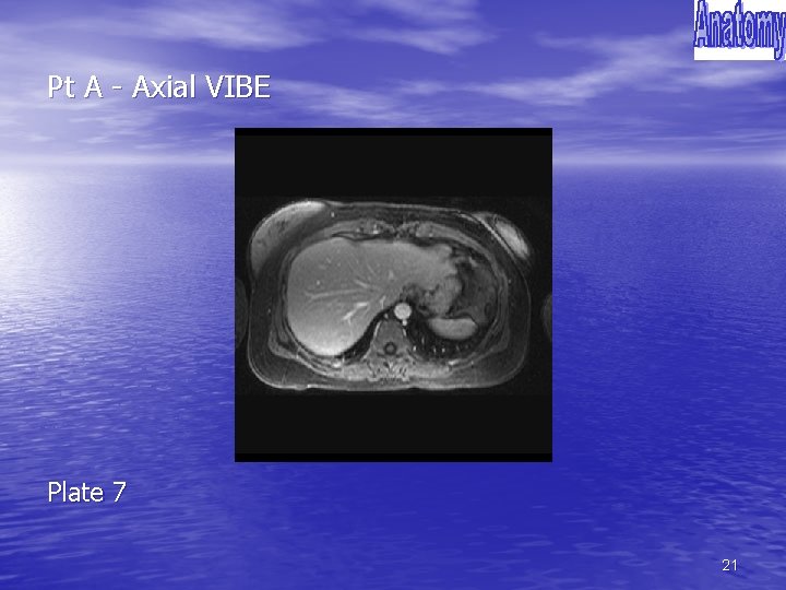 Pt A - Axial VIBE Plate 7 21 