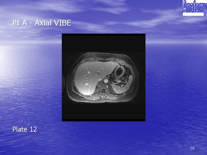 Pt A - Axial VIBE Plate 12 28 