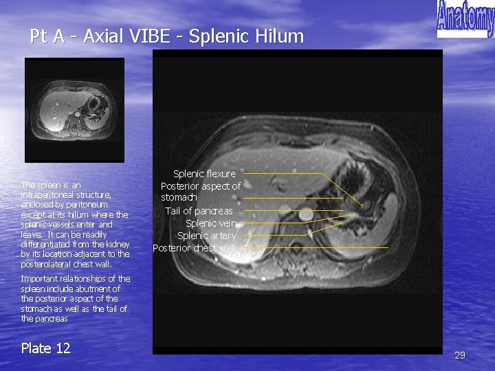 Pt A - Axial VIBE - Splenic Hilum The spleen is an intraperitoneal structure,