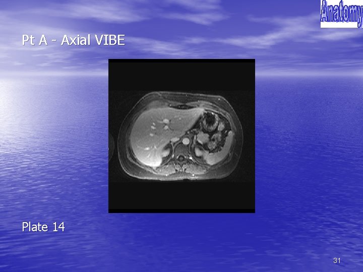 Pt A - Axial VIBE Plate 14 31 