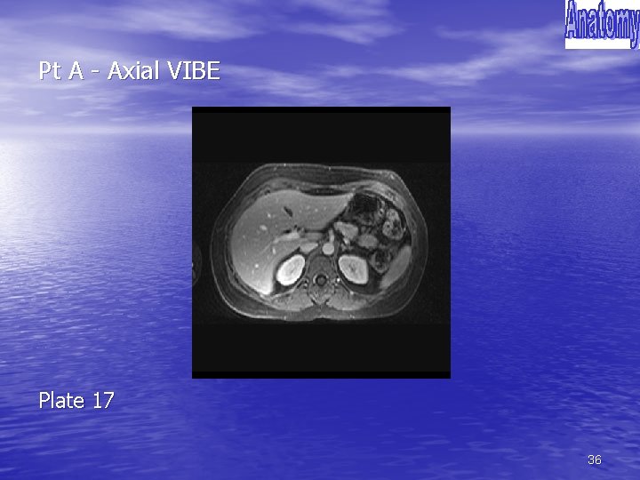 Pt A - Axial VIBE Plate 17 36 