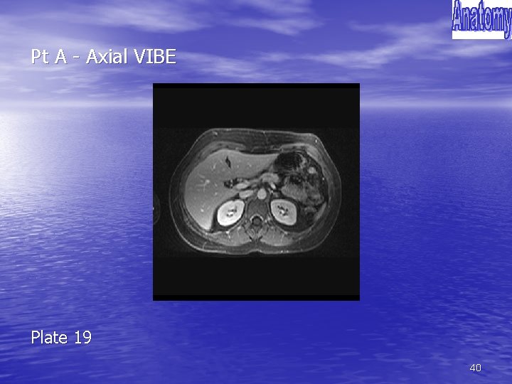 Pt A - Axial VIBE Plate 19 40 