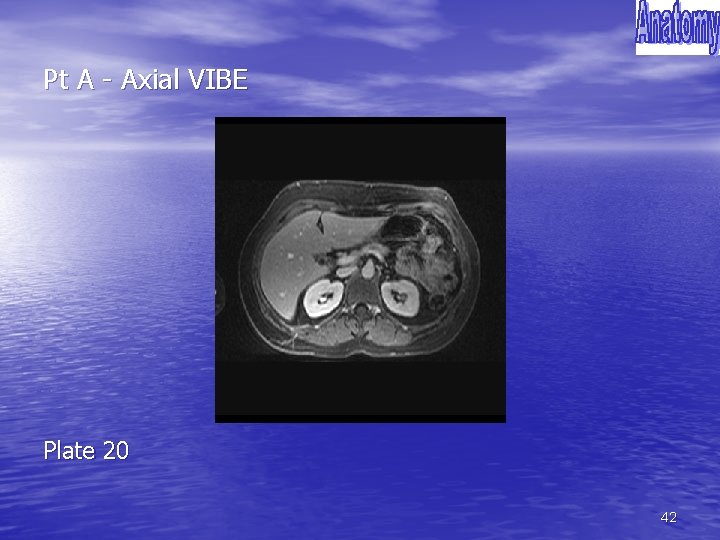 Pt A - Axial VIBE Plate 20 42 