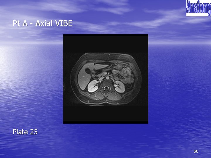 Pt A - Axial VIBE Plate 25 50 