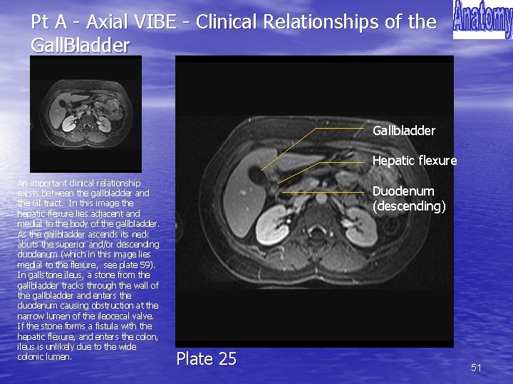 Pt A - Axial VIBE - Clinical Relationships of the Gall. Bladder Gallbladder Hepatic