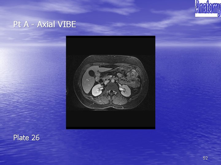 Pt A - Axial VIBE Plate 26 52 