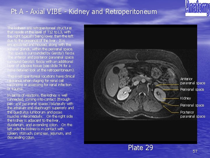 Pt A - Axial VIBE - Kidney and Retroperitoneum The kidneys are retroperitoneal structures