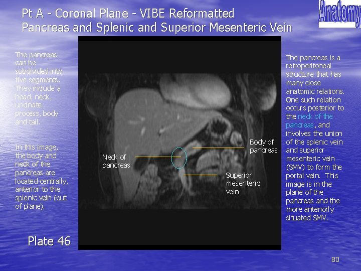 Pt A - Coronal Plane - VIBE Reformatted Pancreas and Splenic and Superior Mesenteric