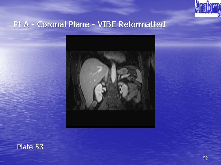 Pt A - Coronal Plane - VIBE Reformatted Plate 53 92 