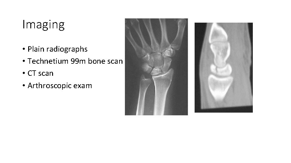 Imaging • Plain radiographs • Technetium 99 m bone scan • CT scan •