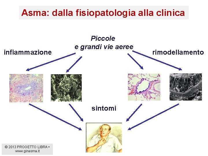 Asma: dalla fisiopatologia alla clinica infiammazione Piccole e grandi vie aeree sintomi © 2013