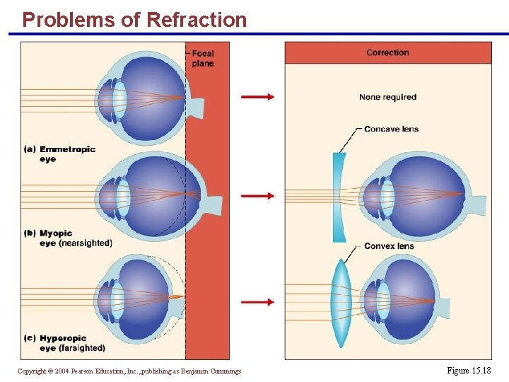 Problems of Refraction Copyright © 2004 Pearson Education, Inc. , publishing as Benjamin Cummings