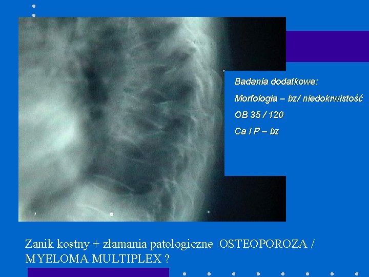 Badania dodatkowe: Morfologia – bz/ niedokrwistość OB 35 / 120 Ca i P –