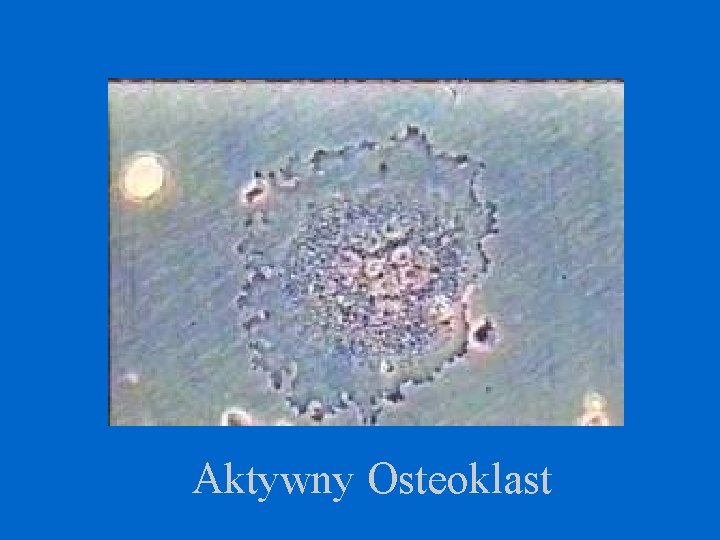 Aktywny Osteoklast 