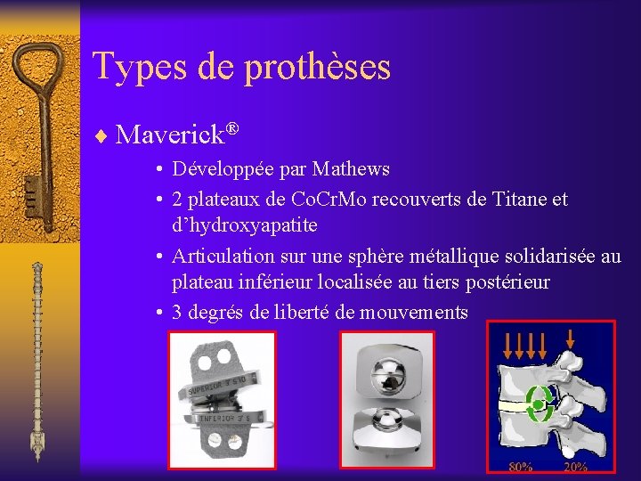 Types de prothèses ¨ Maverick® • Développée par Mathews • 2 plateaux de Co.