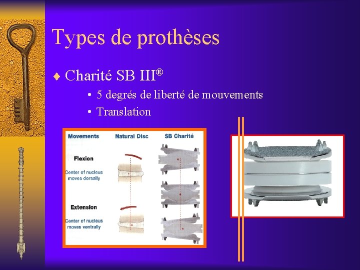 Types de prothèses ¨ Charité SB III® • 5 degrés de liberté de mouvements