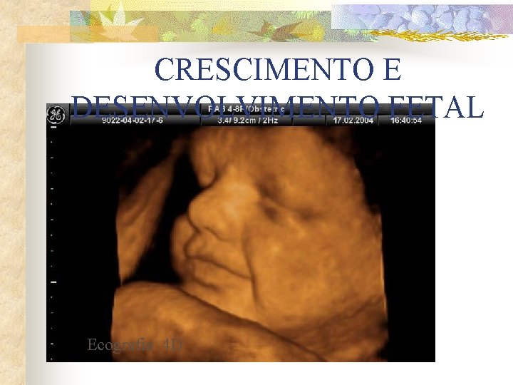 CRESCIMENTO E DESENVOLVIMENTO FETAL Ecografia 4 D 