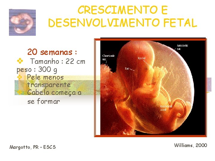 CRESCIMENTO E DESENVOLVIMENTO FETAL 20 semanas : v Tamanho : 22 cm peso :