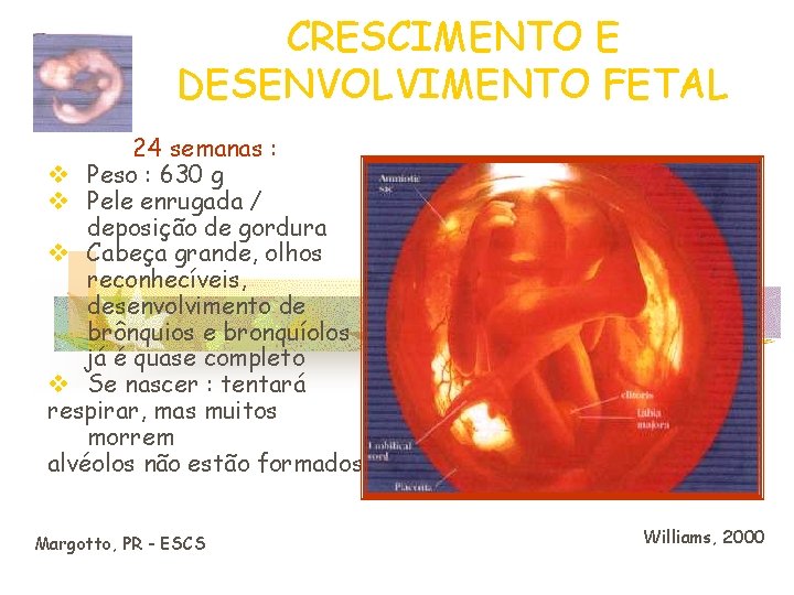 CRESCIMENTO E DESENVOLVIMENTO FETAL 24 semanas : v Peso : 630 g v Pele