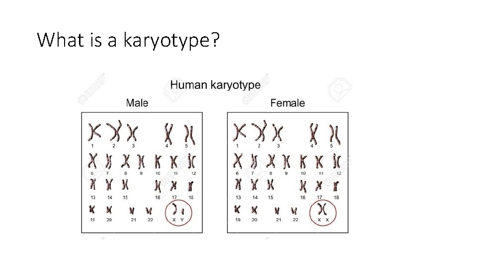 What is a karyotype? 