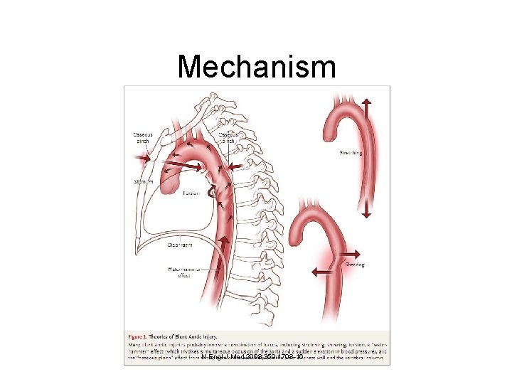 Mechanism N Engl J Med 2008; 359: 1708 -16 