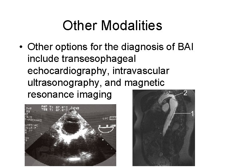 Other Modalities • Other options for the diagnosis of BAI include transesophageal echocardiography, intravascular