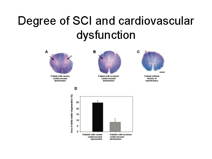 Degree of SCI and cardiovascular dysfunction 