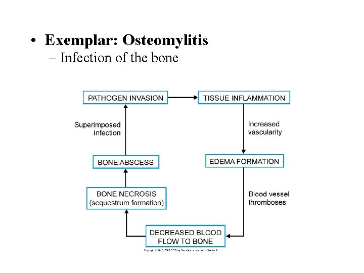  • Exemplar: Osteomylitis – Infection of the bone 