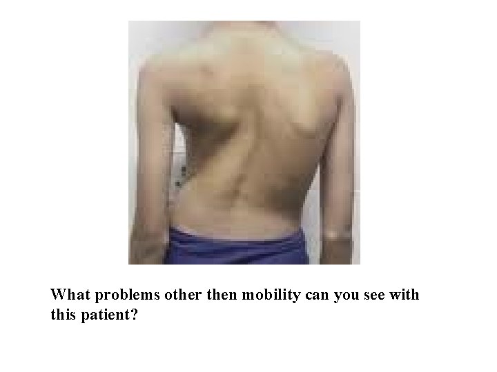  What problems other then mobility can you see with this patient? 