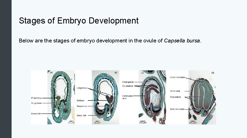 Stages of Embryo Development Below are the stages of embryo development in the ovule