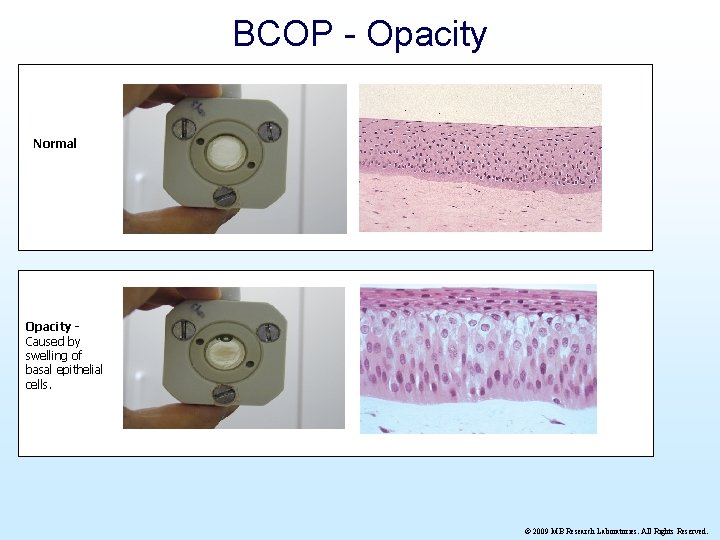 BCOP - Opacity Normal Opacity Caused by swelling of basal epithelial cells. © 2009