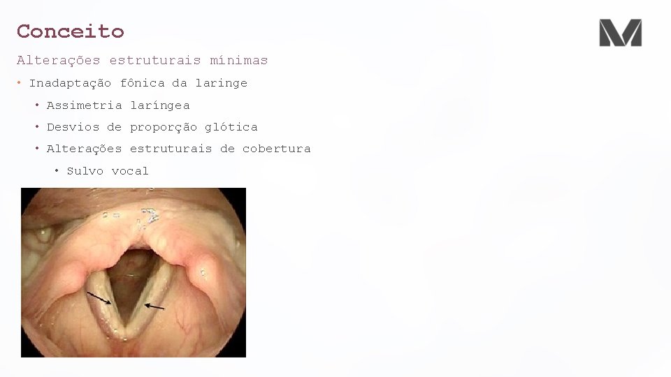 Conceito Alterações estruturais mínimas • Inadaptação fônica da laringe • Assimetria laríngea • Desvios