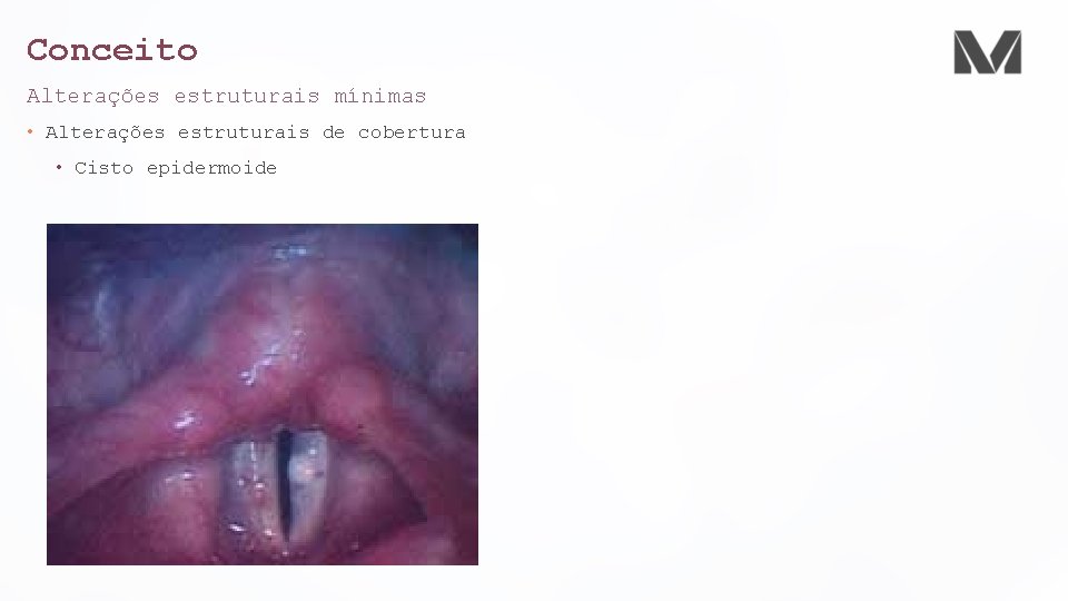 Conceito Alterações estruturais mínimas • Alterações estruturais de cobertura • Cisto epidermoide 