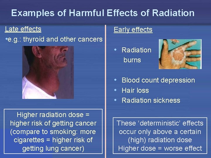 Examples of Harmful Effects of Radiation Late effects • e. g. : thyroid and