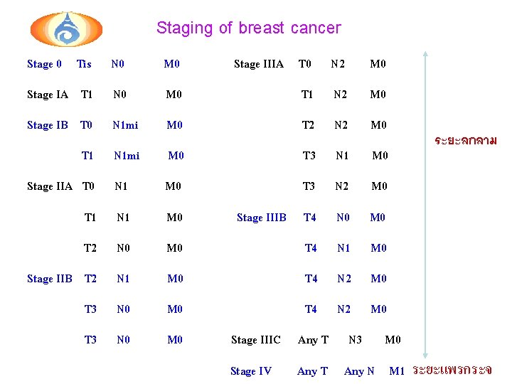 Staging of breast cancer Stage 0 Tis N 0 M 0 Stage IIIA T