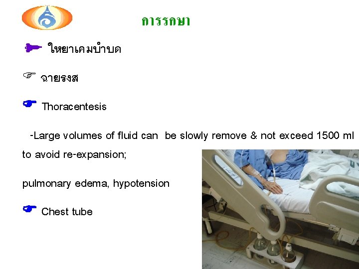 การรกษา ใหยาเคมบำบด F ฉายรงส Thoracentesis -Large volumes of fluid can be slowly remove &