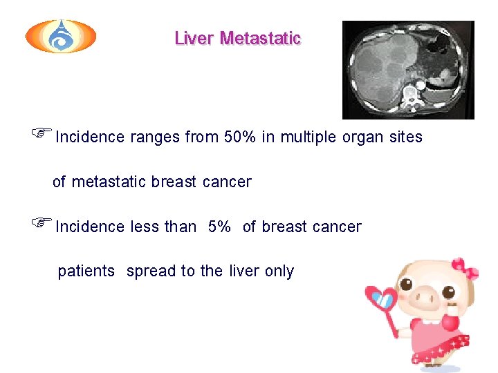 Liver Metastatic F Incidence ranges from 50% in multiple organ sites of metastatic breast