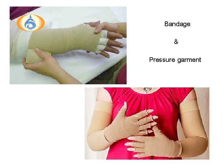 Bandage & Pressure garment 