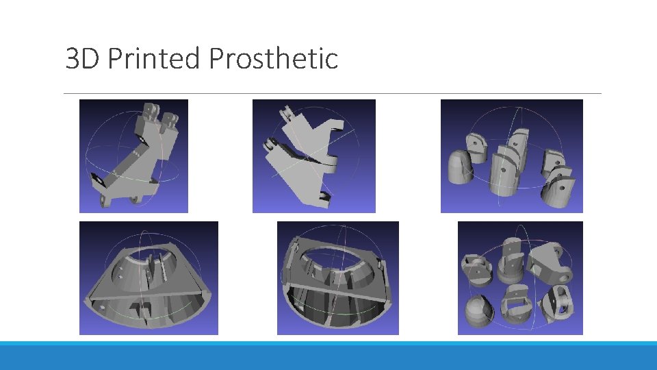 3 D Printed Prosthetic 