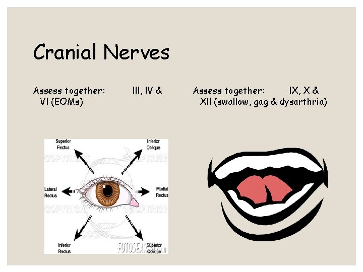 Cranial Nerves Assess together: Vl (EOMs) lll, l. V & Assess together: l. X, Cranial Nerves Assess together: Vl (EOMs) lll, l. V & Assess together: l. X,