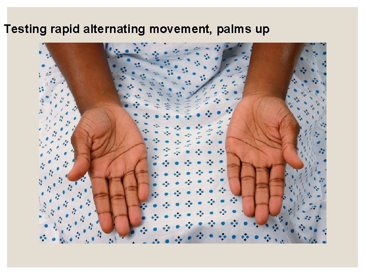 Testing rapid alternating movement, palms up Testing rapid alternating movement, palms up
