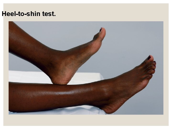 Heel-to-shin test. Heel-to-shin test.