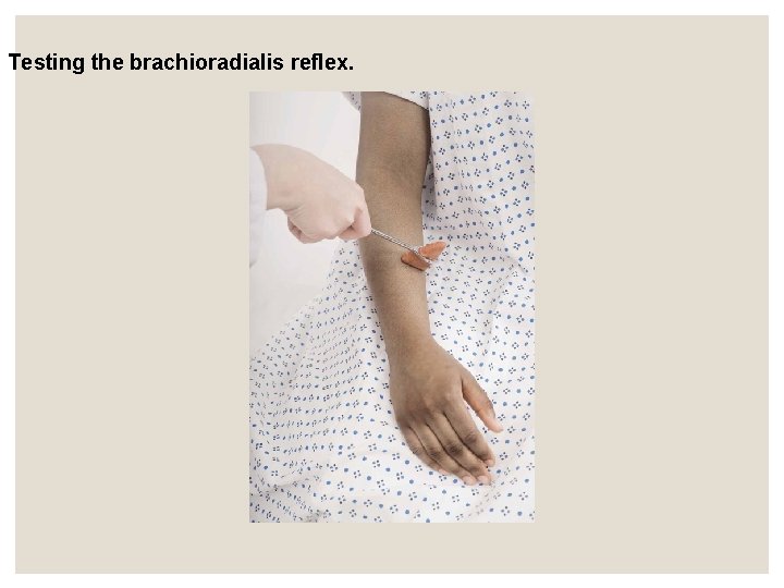 Testing the brachioradialis reflex. Testing the brachioradialis reflex.