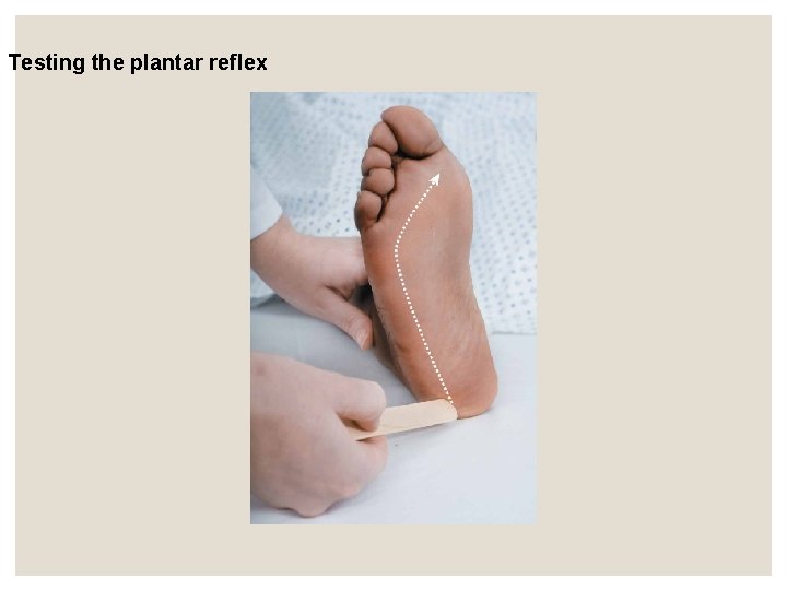Testing the plantar reflex Testing the plantar reflex